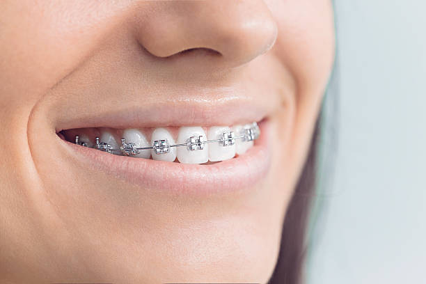Best Wisdom Tooth Removal  in North Star, DE